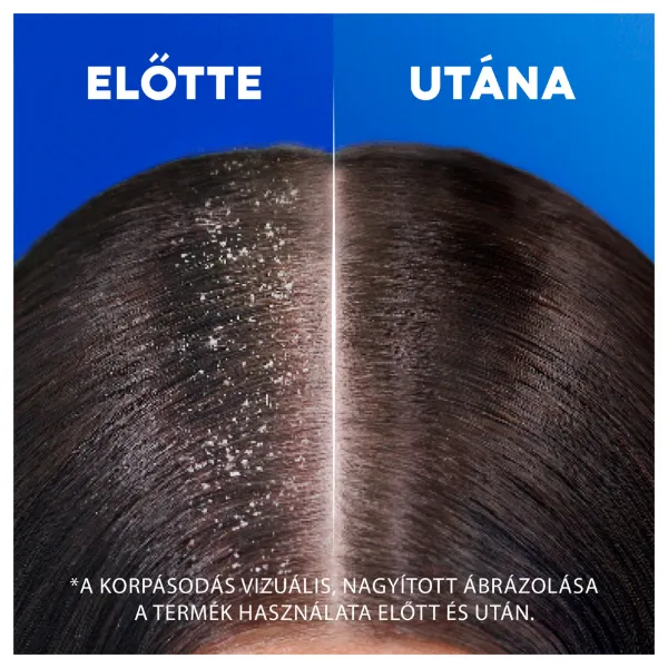 Head & Shoulders Citrus Fresh korpásodás elleni sampon zsíros hajra 250ml napi használatra termékhez kapcsolódó kép
