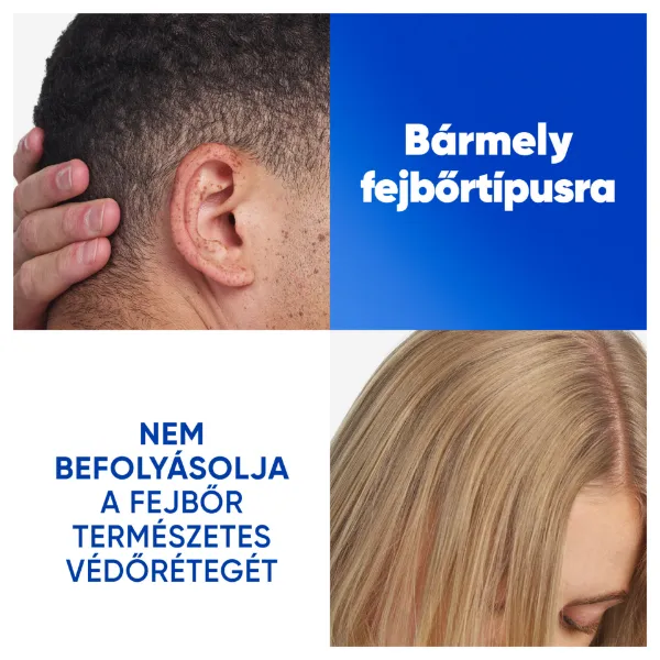 Head & Shoulders Citrus Fresh korpásodás elleni sampon zsíros hajra 250ml napi használatra termékhez kapcsolódó kép