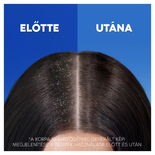 Head & Shoulders Thick & Strong 2az1-ben Sampon És Balzsam Az Akár 100%-os Korpamentességért termékhez kapcsolódó kép