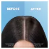 Head & Shoulders Apple Fresh Korpásodás Elleni Sampon, 900 ml termékhez kapcsolódó kép