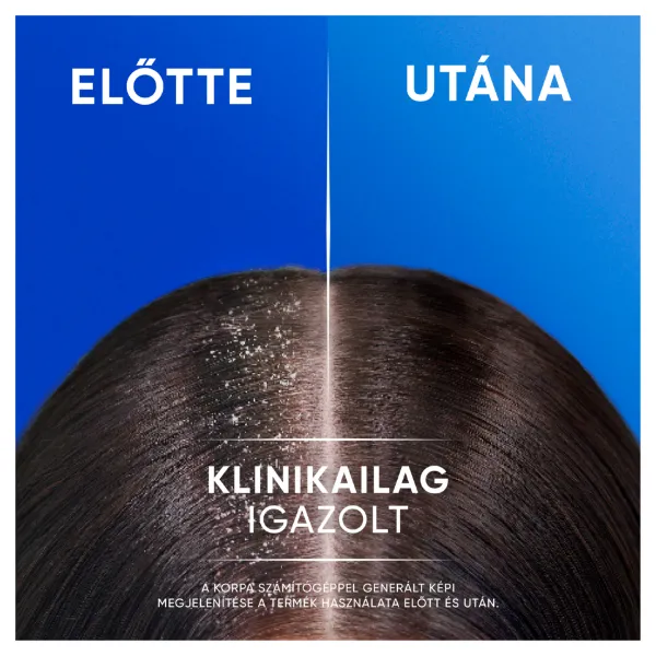 Head & Shoulders Classic Clean 2az1-ben korpásodás elleni sampon 400ml. Friss tiszta Illat termékhez kapcsolódó kép