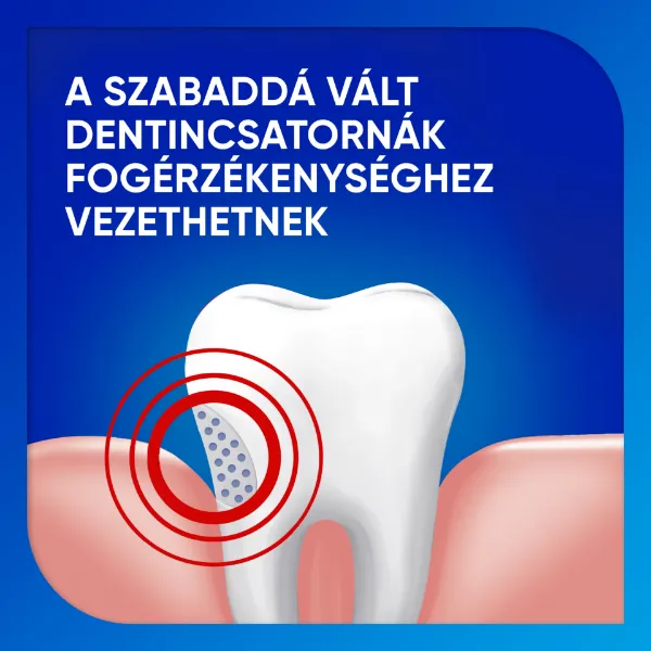 Sensodyne fogkrém 75ml Fluoridos fogszuvasodás elleni termékhez kapcsolódó kép