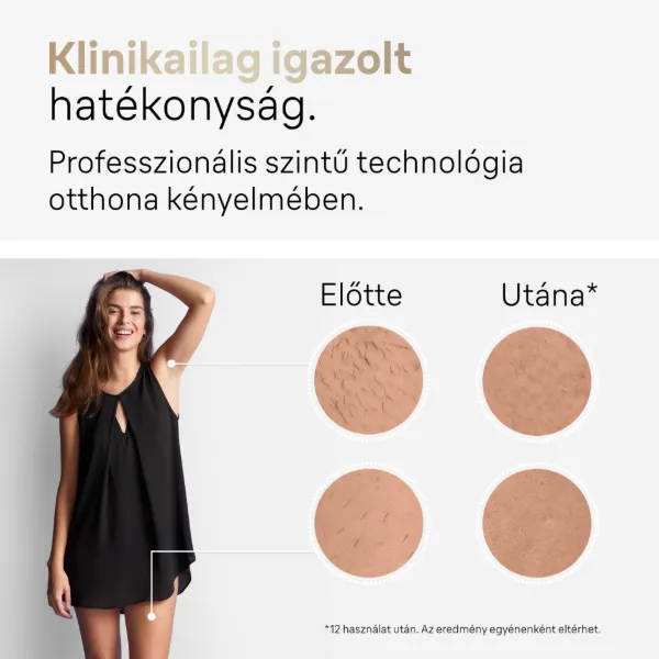 Braun IPL Silk expert Pro 5, Szőrtelenítés Otthoni Kezeléssel, Neszesszer, 2 Fej, PL5146 termékhez kapcsolódó kép